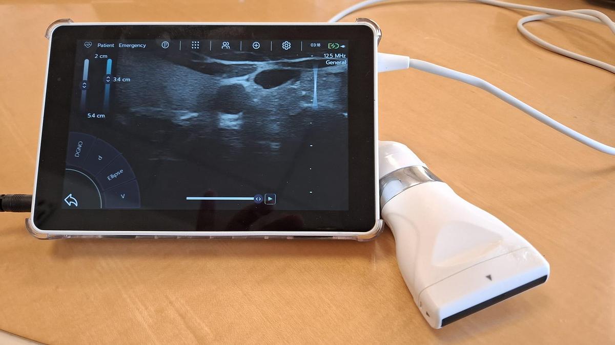 D'occasion ECHOGRAPHE SUPER PORTABLE SONOSCANNER U-LITE PRO 