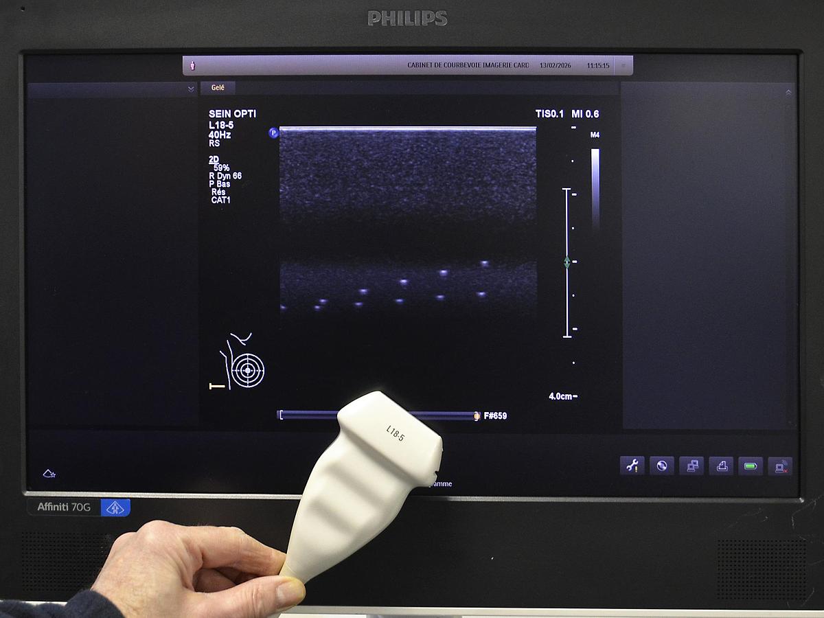 D'occasion ECHOGRAPHE PHILIPS AFFINITI 70G