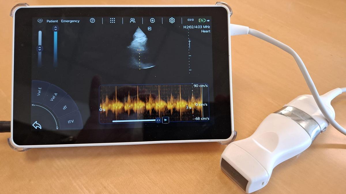 D'occasion ECHOGRAPHE SUPER PORTABLE SONOSCANNER U-LITE PRO 