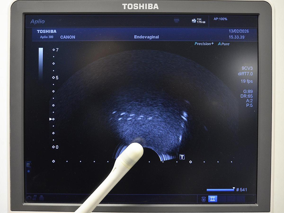 D'occasion ECHOGRAPHE TOSHIBA APLIO 300