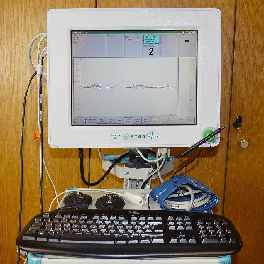 D'occasion TOCOCARDIOGRAPHE NEOVENTA STAN 31 AVEC SONDE TOCO, SONDE CARDIO MONITORAGE DE LA MÈRE (PNI, SPO2)