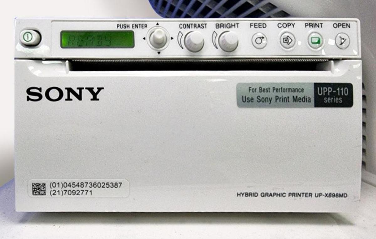 D'occasion ECHOGRAPHE HITACHI ALOKA ARIETTA V70 