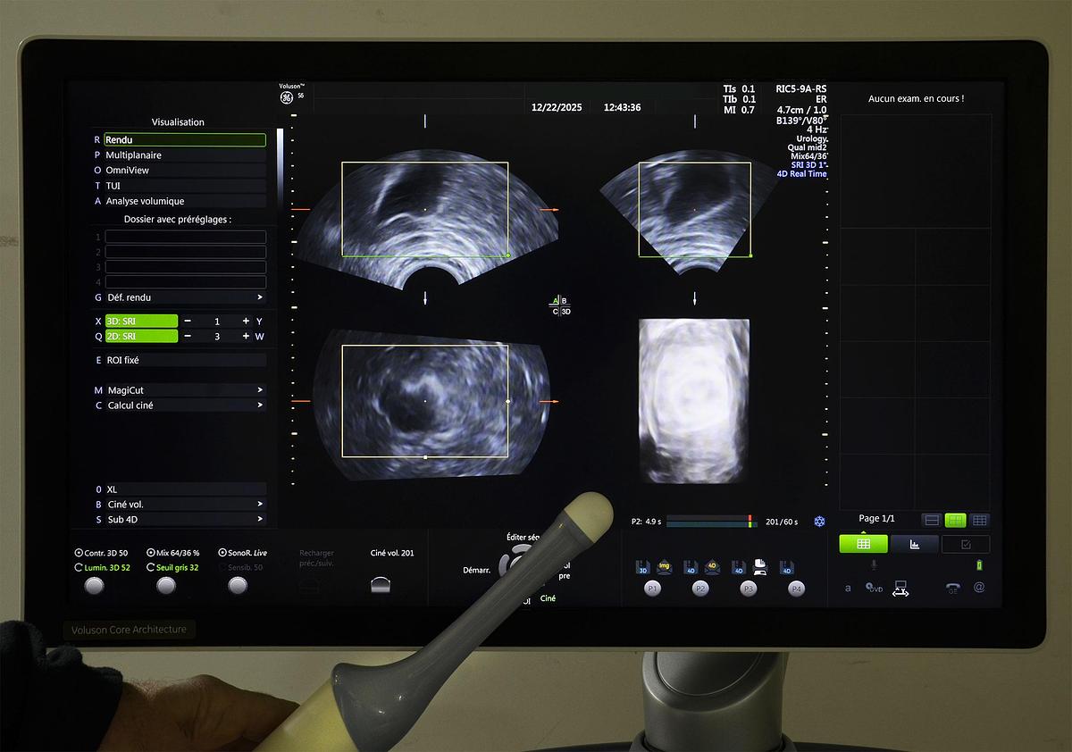 D'occasion ECHOGRAPHE GENERAL ELECTRIC VOLUSON S6 