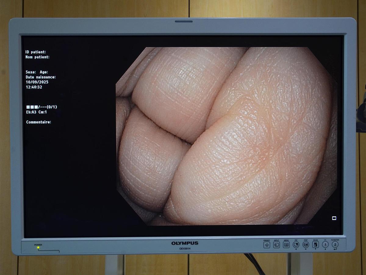 D'occasion COLONNE OLYMPUS EXERA III CV190 AVEC 2 ENDOSCOPES