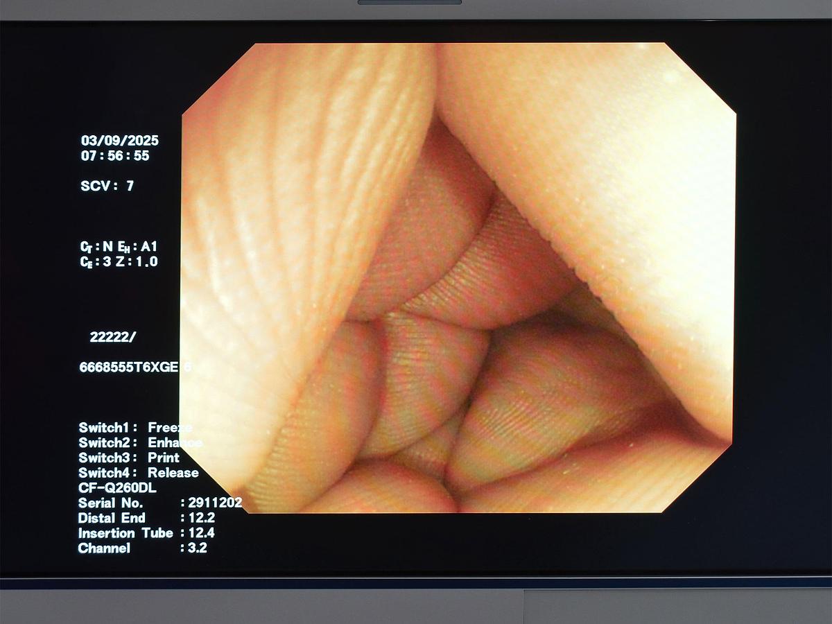 D'occasion VIDEO COLONOSCOPE OLYMPUS-CF-Q260DL