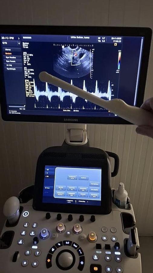 D'occasion SONDE TRANSDUCTRICE TRANSVAGINALE SAMSUNG ER4-9