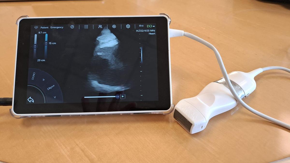 D'occasion ECHOGRAPHE SUPER PORTABLE SONOSCANNER U-LITE PRO 