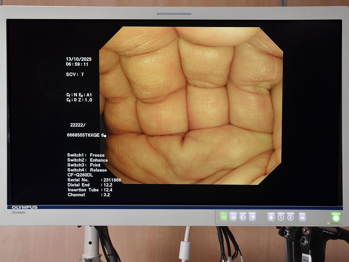 D'occasion COLONNE D'ENDOSCOPIE GASTRO DIGESTIVE OLYMPUS 260