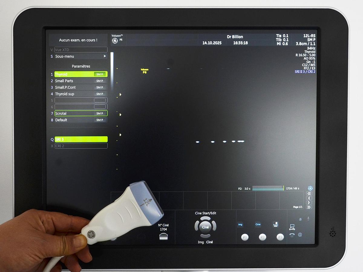 D'occasion ECHOGRAPHE GE VOLUSON P6