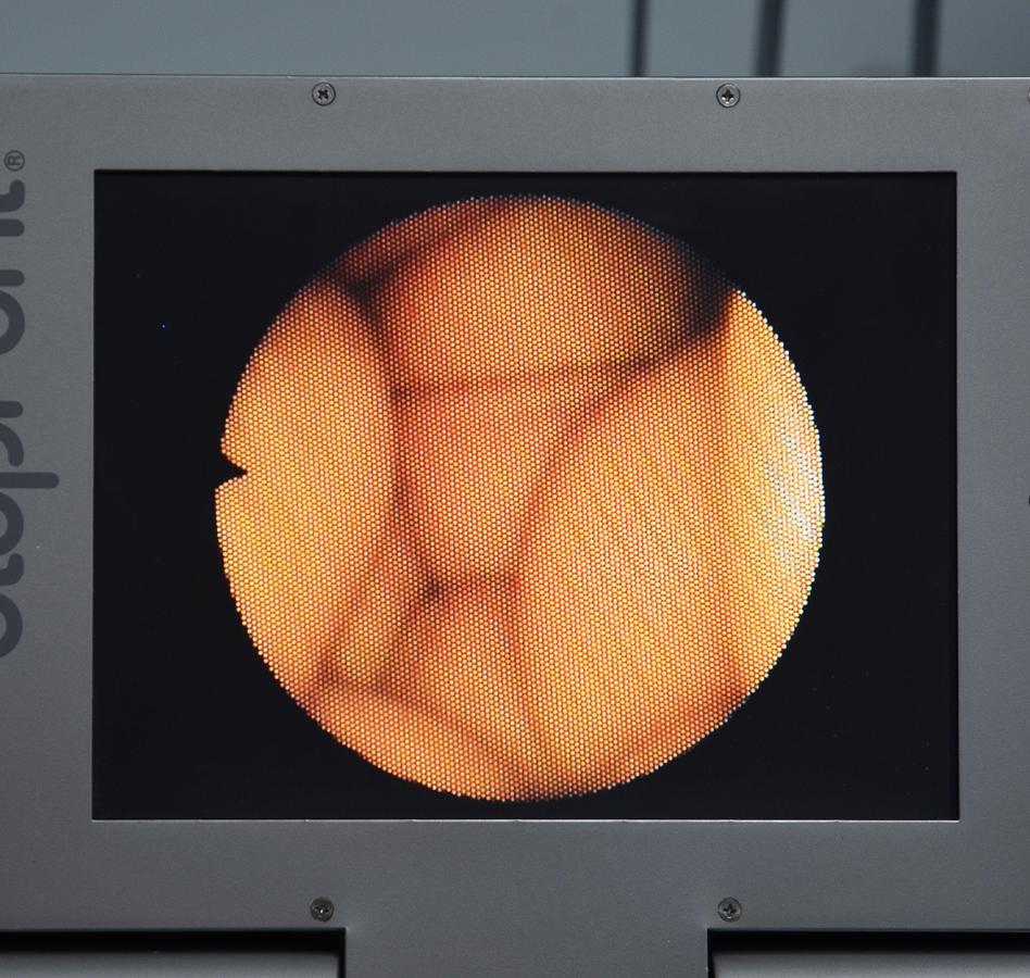 D'occasion UNITÉ DE CONSULTATION POURET AVEC NASOFIBROSCOPE MACHIDA, INCLUANT ÉCRAN ET SYSTÈME VIDÉO