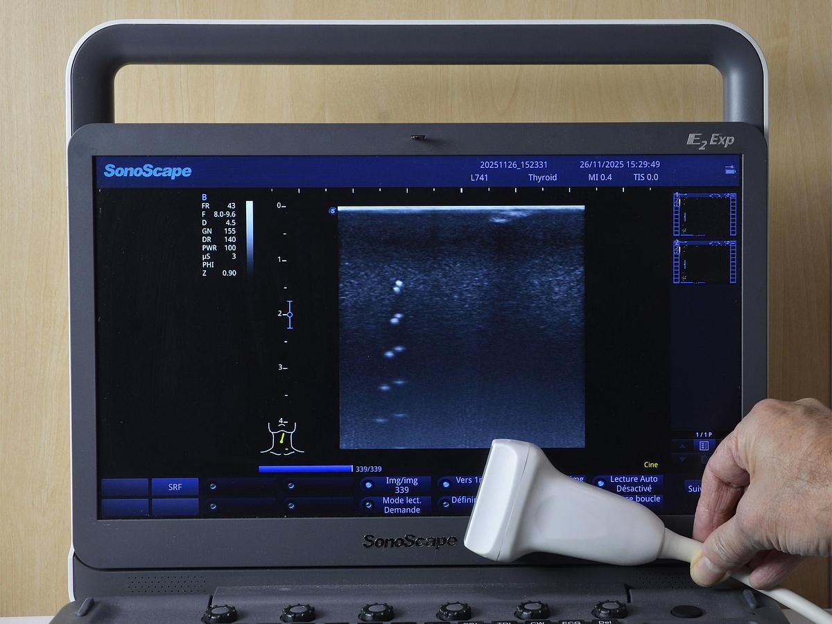 D'occasion ECHOGRAPHE SONOSCAPE X3 Exp