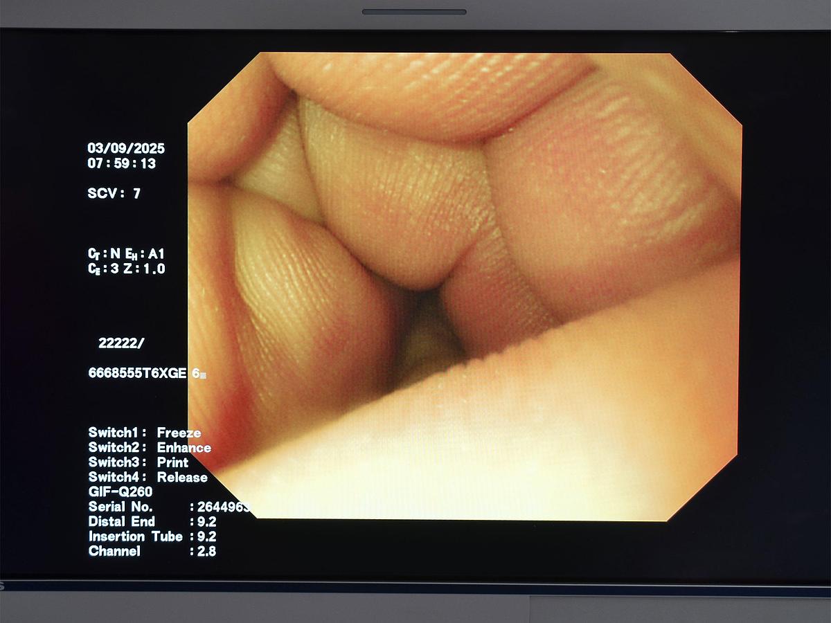 D'occasion VIDEO GASTROSCOPE OLYMPUS-GIF-Q260