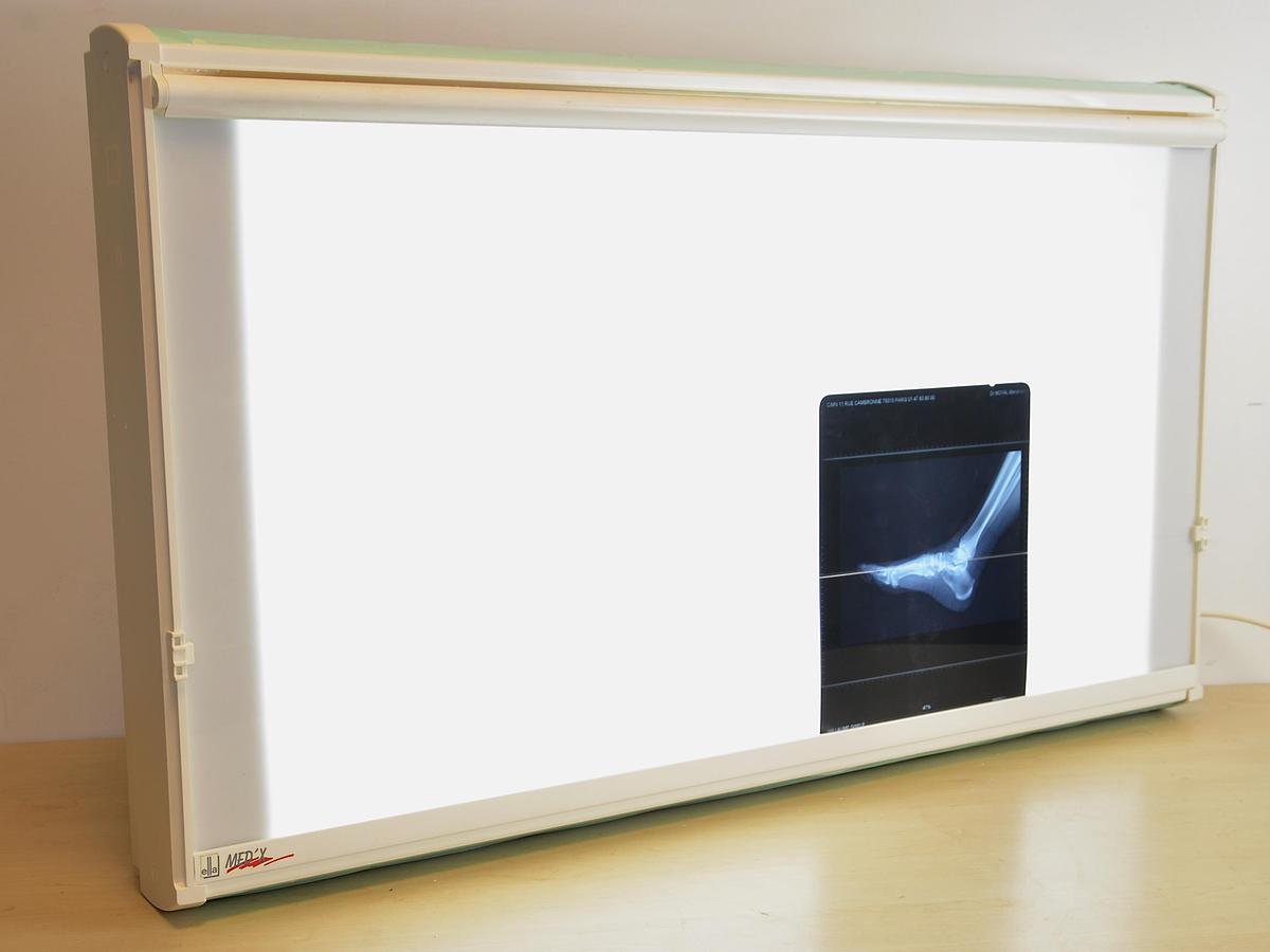 Neuf NEGATOSCOPE ELLA MED'X 1 PLAGE