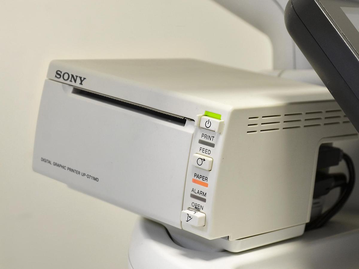 D'occasion ECHOGRAPHE PHILIPS AFFINITI 70G