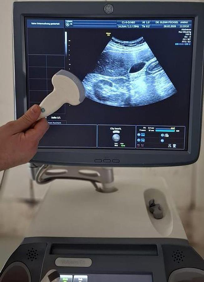 D'occasion ECHOGRAPHE  GENERAL ELECTRIC VOLUSON E6