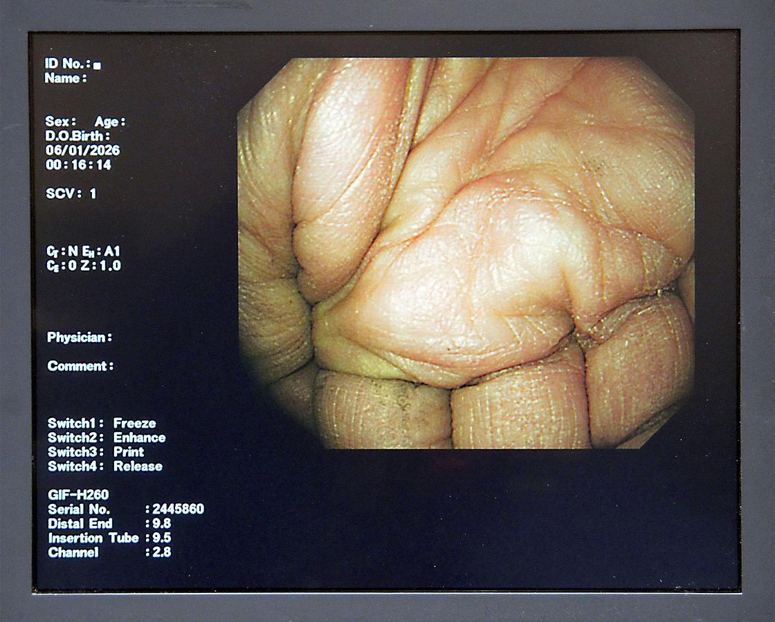 D'occasion VIDEO GASTROSCOPE OLYMPUS GIF-H260