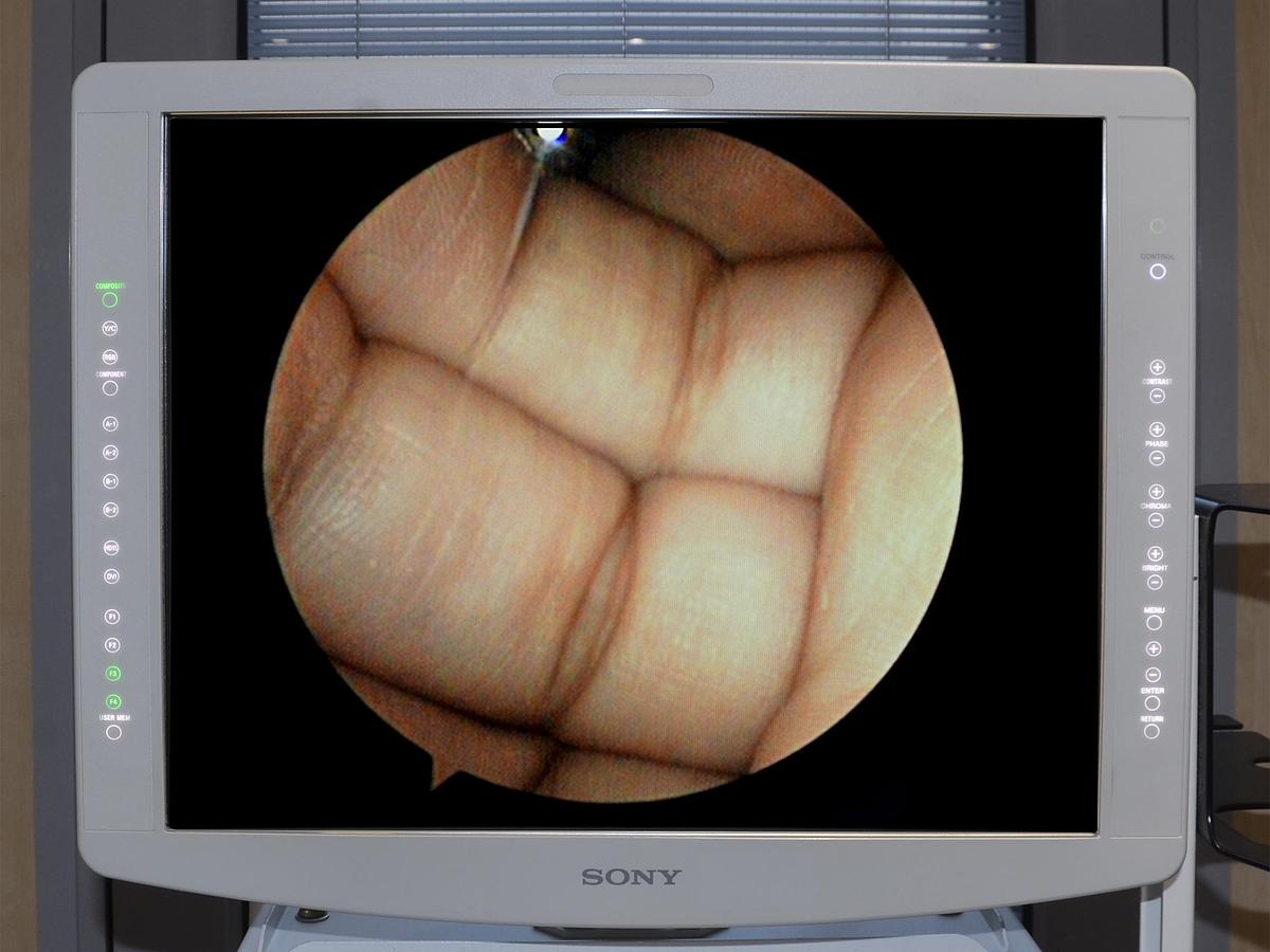 D'occasion COLONNE D'ENDOSCOPIE RIGIDE OLYMPUS VISERA 