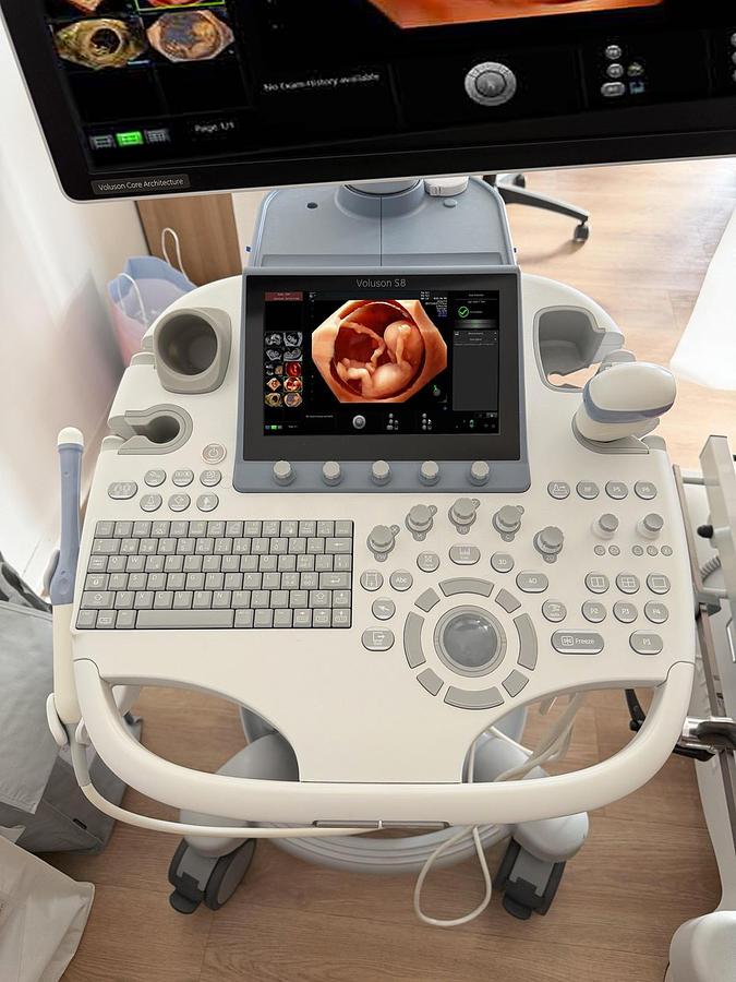 D'occasion ECHOGRAPHE GE HEALTHCARE VOLUSON S8 BT22