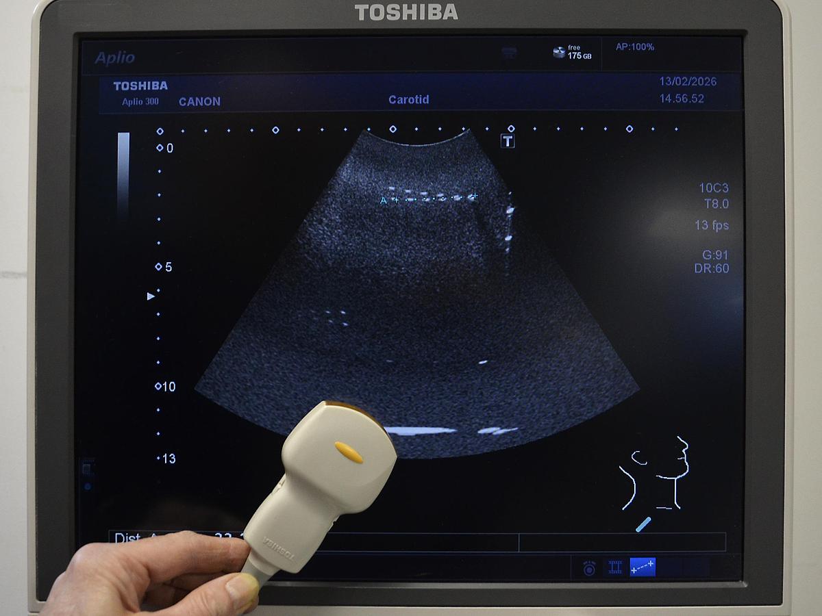 D'occasion ECHOGRAPHE TOSHIBA APLIO 300