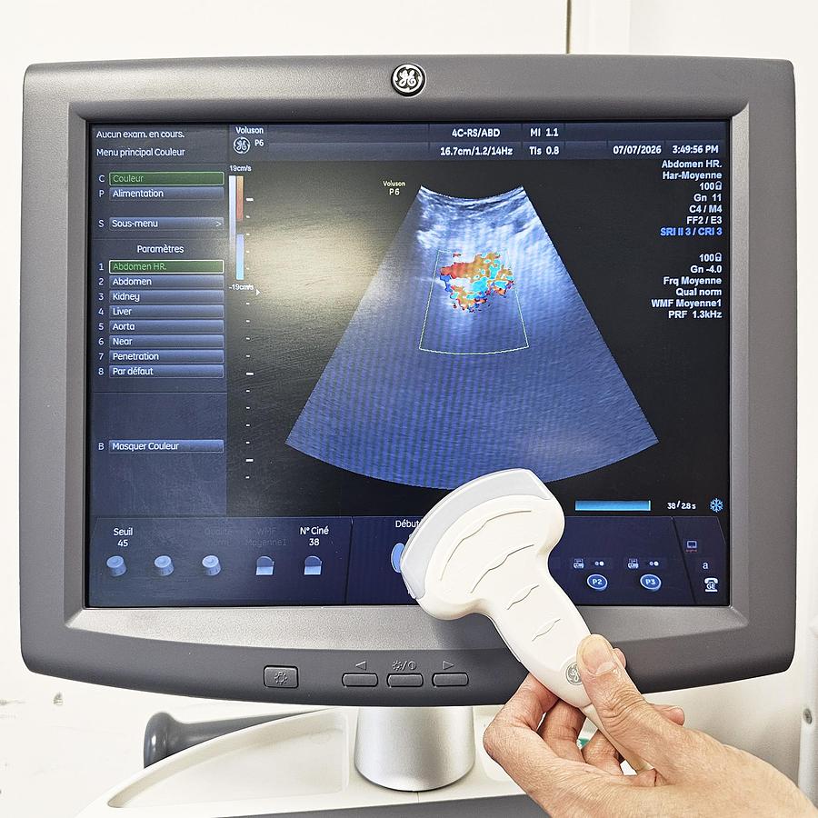 D'occasion ECHOGRAPHE GE VOLUSON P6