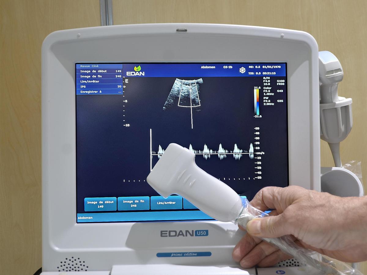 Neuf ECHOGRAPHE PORTABLE EDAN U50 AVEC DEUX SONDES