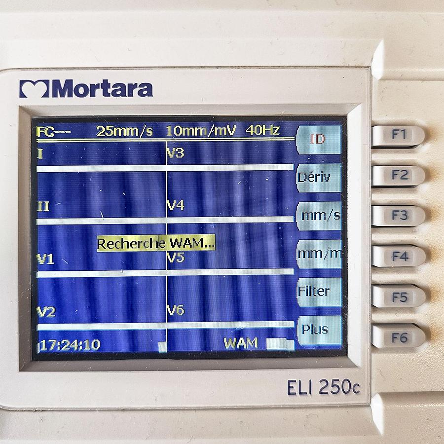 D'occasion ECG MORTARA ELI 250c
