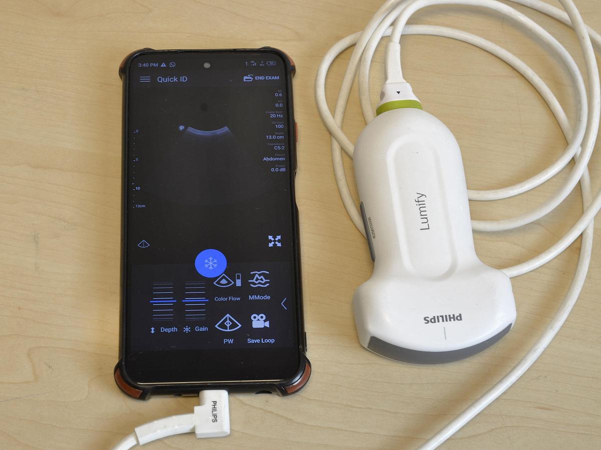 D'occasion SONDE CONVEXE LUMIFY C5-2