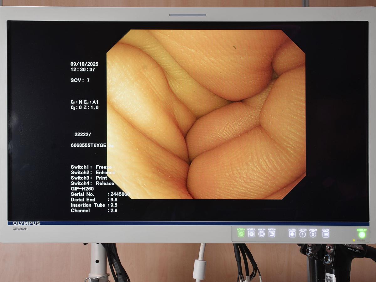 D'occasion COLONNE D'ENDOSCOPIE GASTRO DIGESTIVE OLYMPUS 260