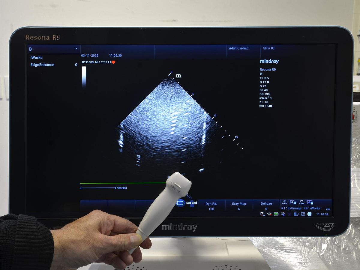 D'occasion ECHOGRAPHE MINDRAY RESONA R9