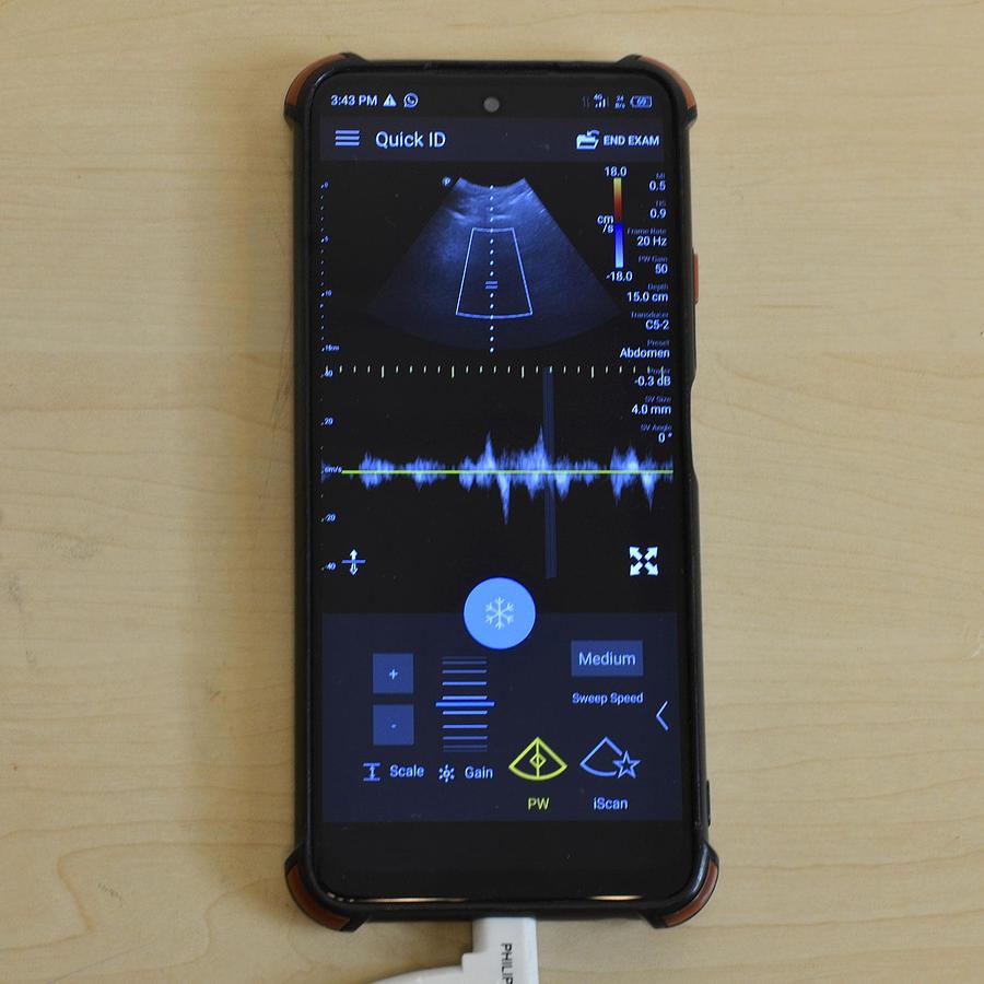 D'occasion SONDE CONVEXE LUMIFY C5-2