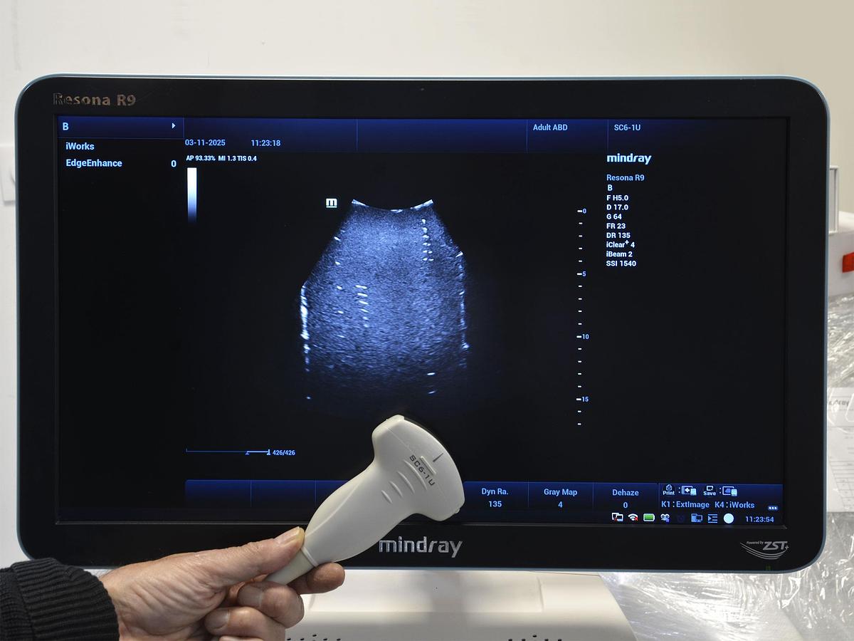 D'occasion ECHOGRAPHE MINDRAY RESONA R9