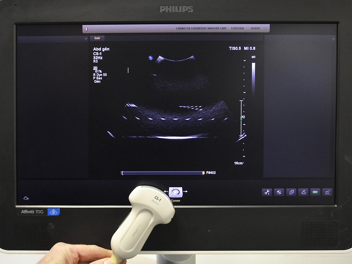 D'occasion ECHOGRAPHE PHILIPS AFFINITI 70G