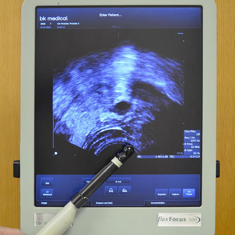 D'occasion ECHOGRAPHE BK MEDICAL FOCUS 500