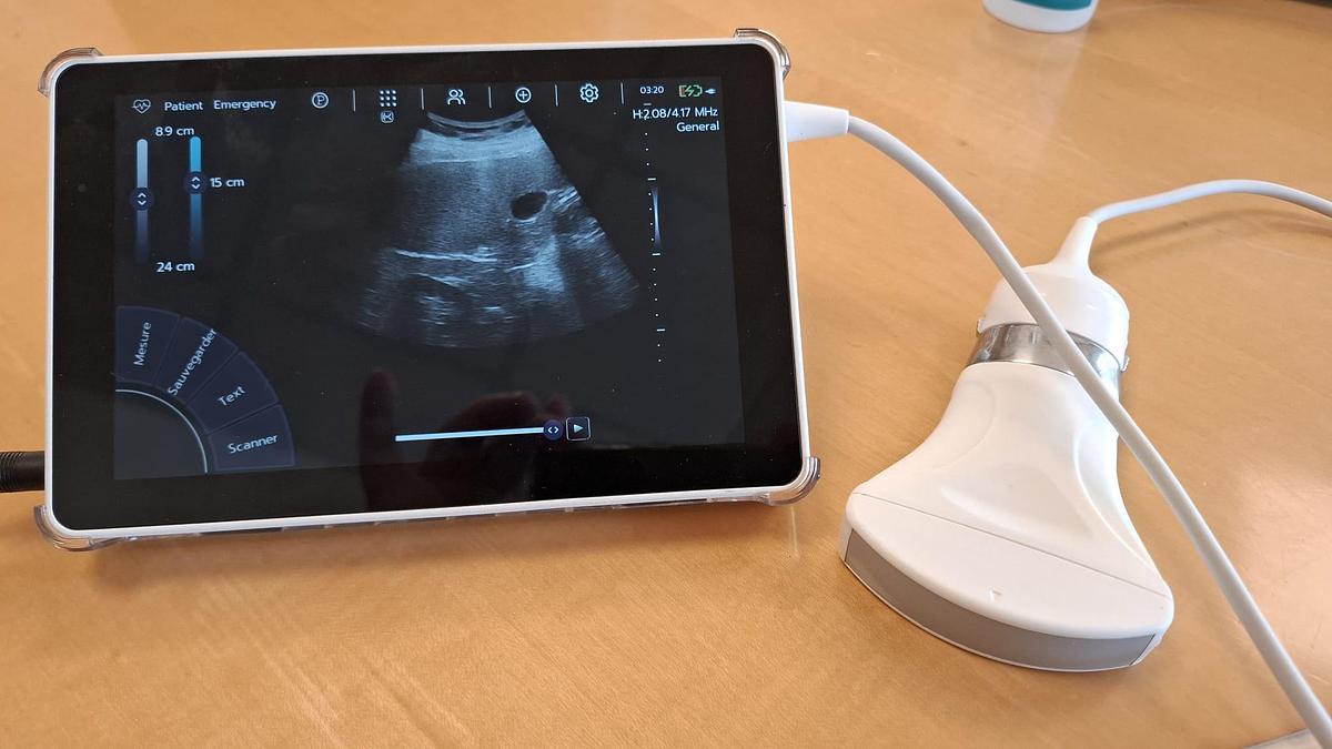 D'occasion ECHOGRAPHE SUPER PORTABLE SONOSCANNER U-LITE PRO 