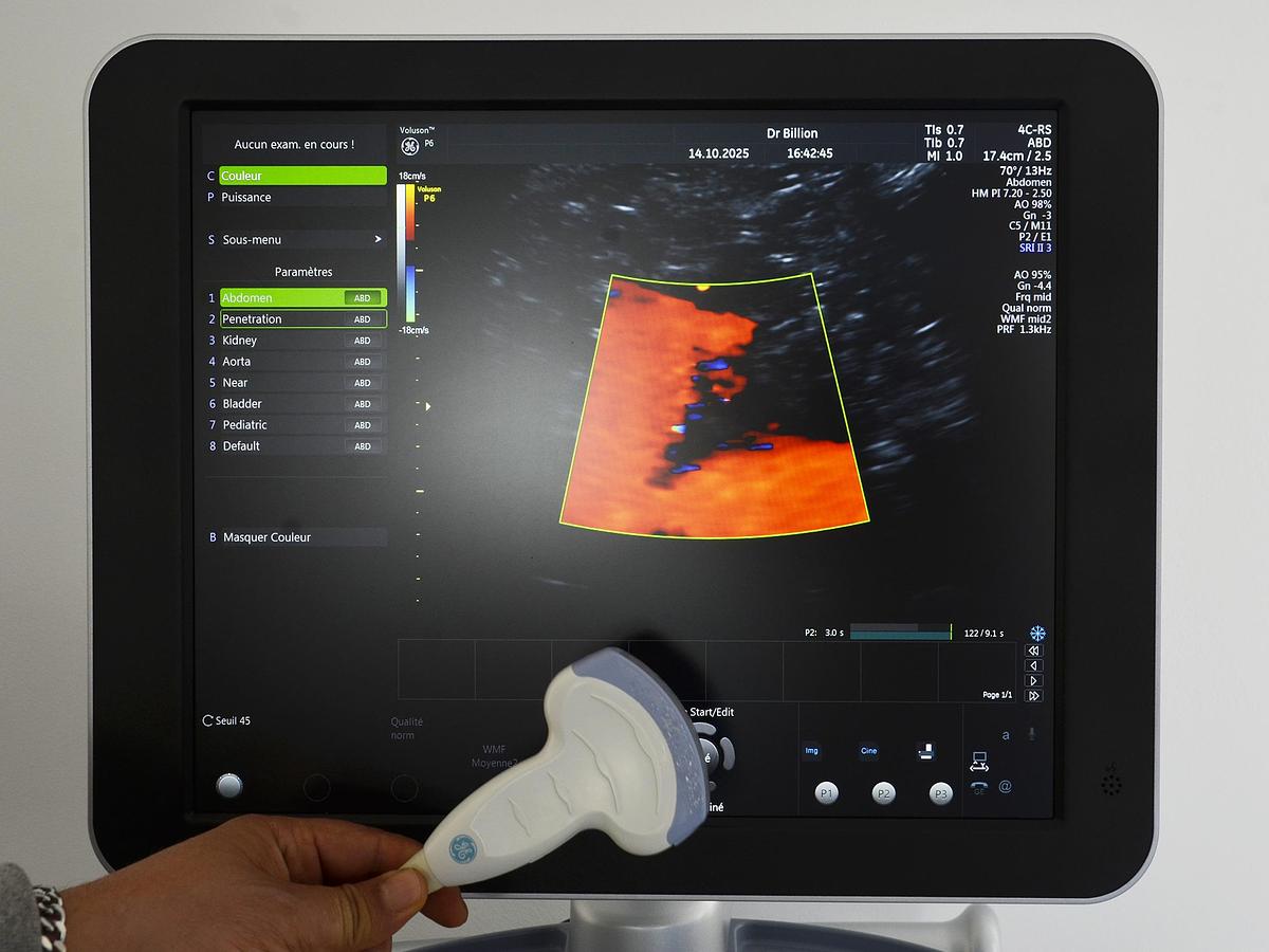 D'occasion ECHOGRAPHE GE VOLUSON P6