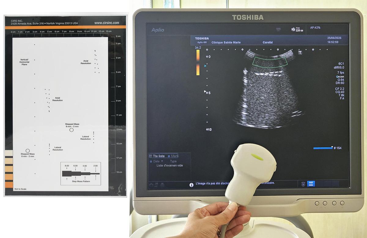 D'occasion ECHOGRAPHE TOSHIBA APLIO 400