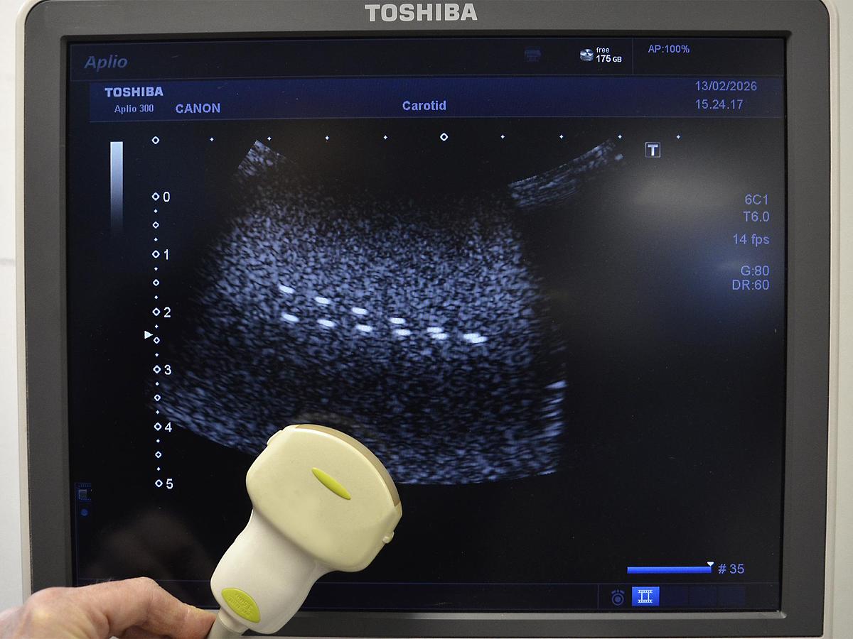 D'occasion ECHOGRAPHE TOSHIBA APLIO 300