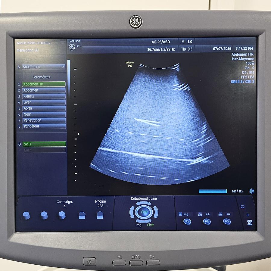 D'occasion ECHOGRAPHE GE VOLUSON P6
