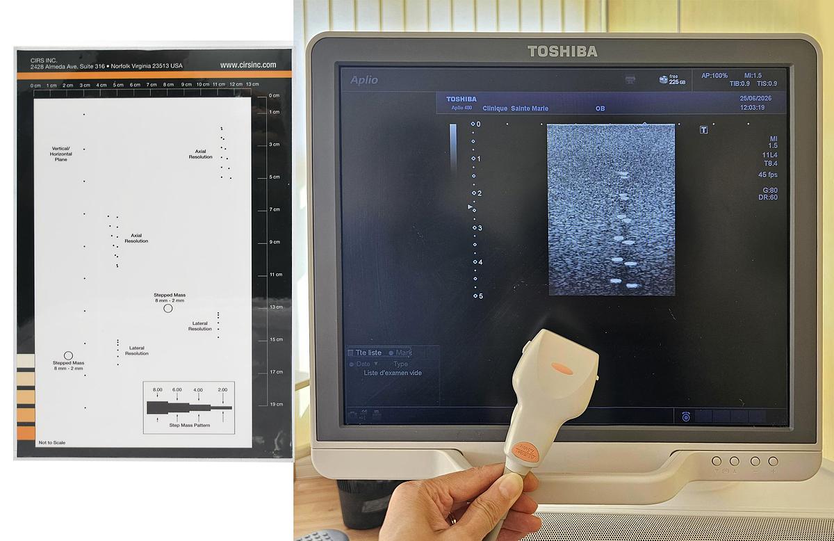 D'occasion ECHOGRAPHE TOSHIBA APLIO 400