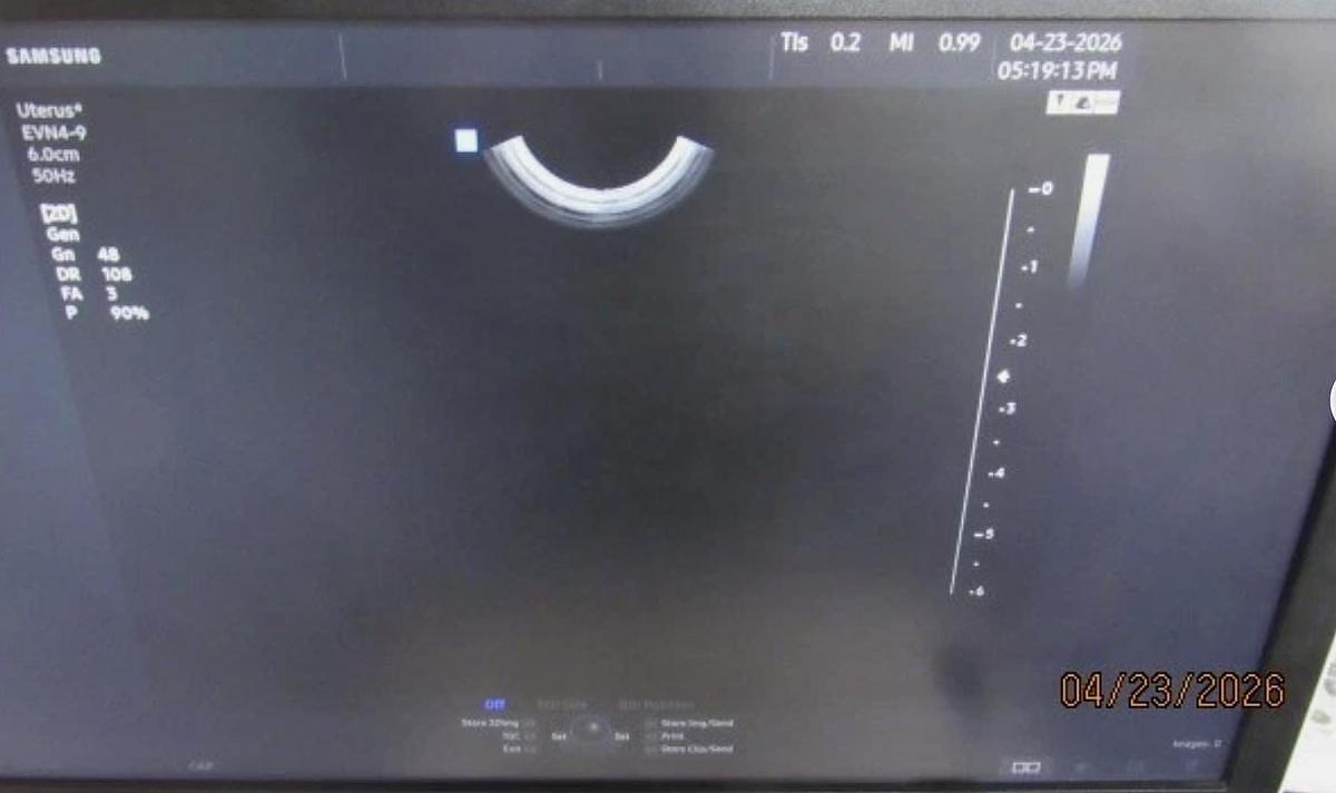 D'occasion ECHOGRAPHE SAMSUNG HS50 (11/2020)