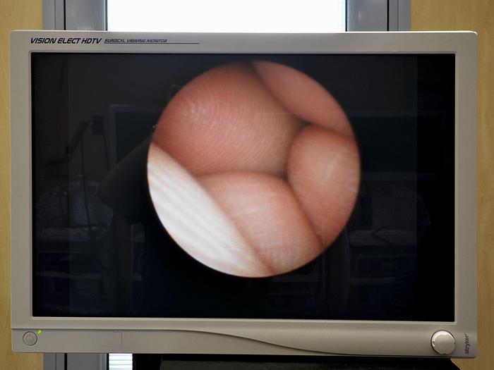 Neuf URETEROSCOPE SEMI RIGIDE 7.5/12.5FR  430MM