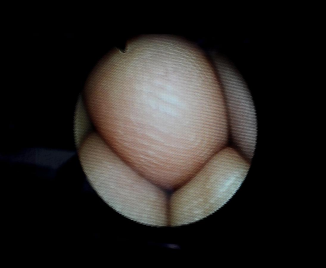 Neuf CYSTOSCOPE HYSTEROSCOPE COGENTIX CST 4000