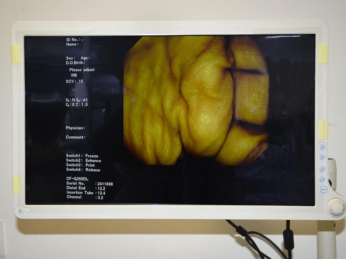 D'occasion COLONNE OLYMPUS D'ENDOSCOPIE DIGESTIVE SERIE 260