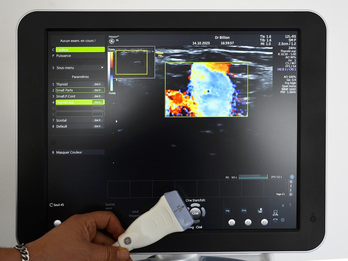 D'occasion ECHOGRAPHE GE VOLUSON P6