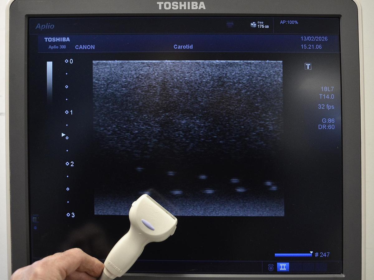 D'occasion ECHOGRAPHE TOSHIBA APLIO 300