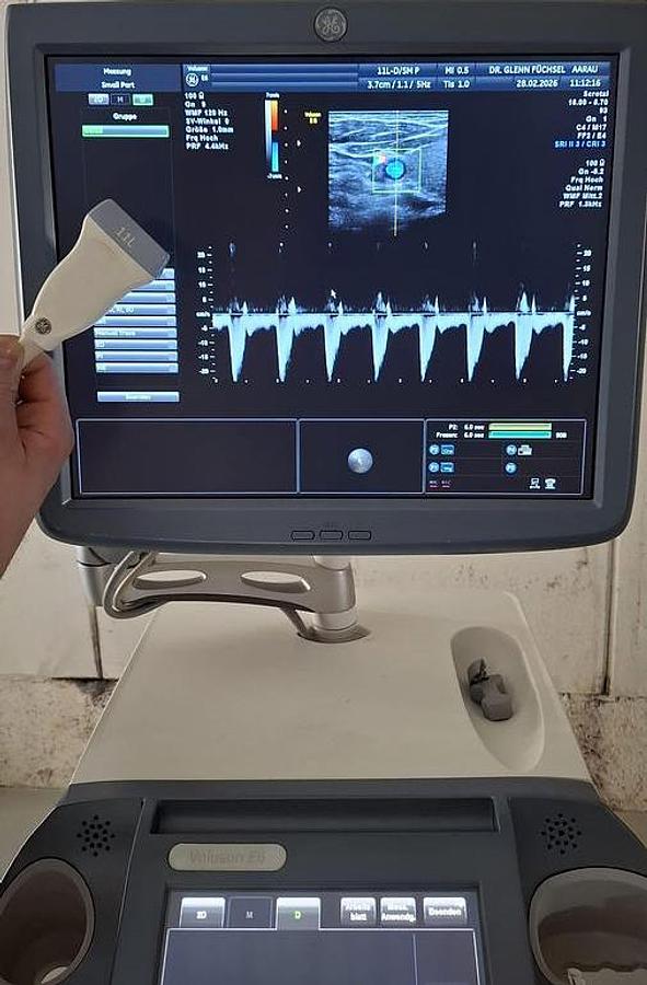D'occasion ECHOGRAPHE  GENERAL ELECTRIC VOLUSON E6