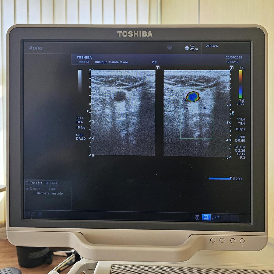 D'occasion ECHOGRAPHE TOSHIBA APLIO 400