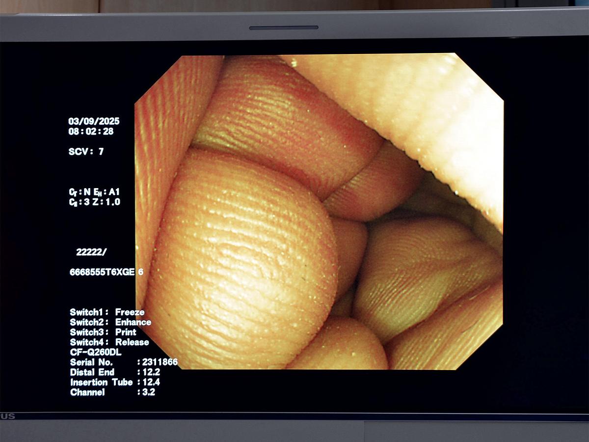 D'occasion VIDEO COLONOSCOPE OLYMPUS-CF-Q260DL