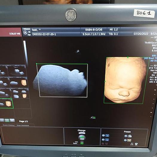 Gebraucht GE Voluson E8 Flachbildschirm Ultraschallgerät inkl. IC5-9-D Sonde und Sony UP-D897 Drucker Ultrasound
