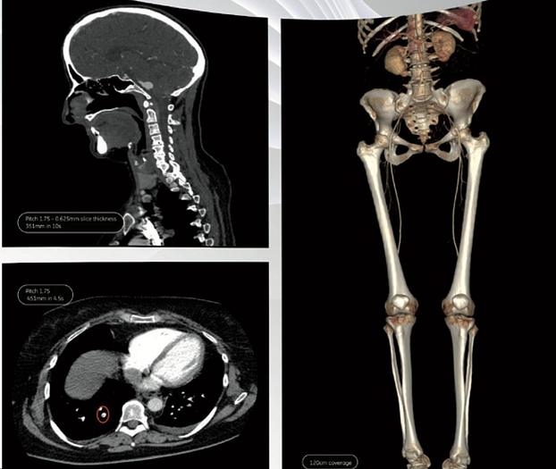 Refurbished 2008 General Electric (GE) LightSpeed VCT